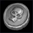 Achievement114